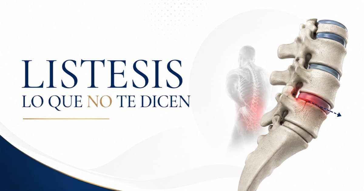 Listesis sus signos y síntomas y cómo manejarlo
